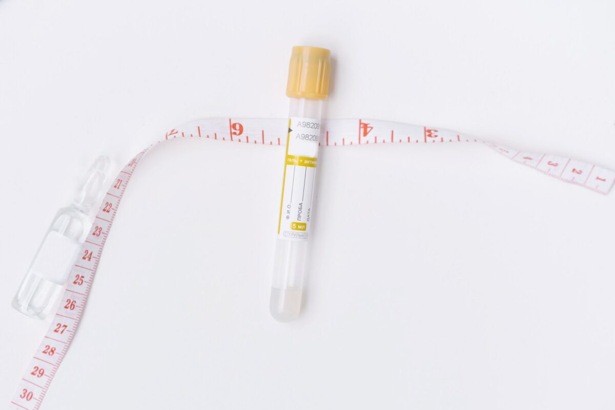 sonde urinaire chez demander avis médical