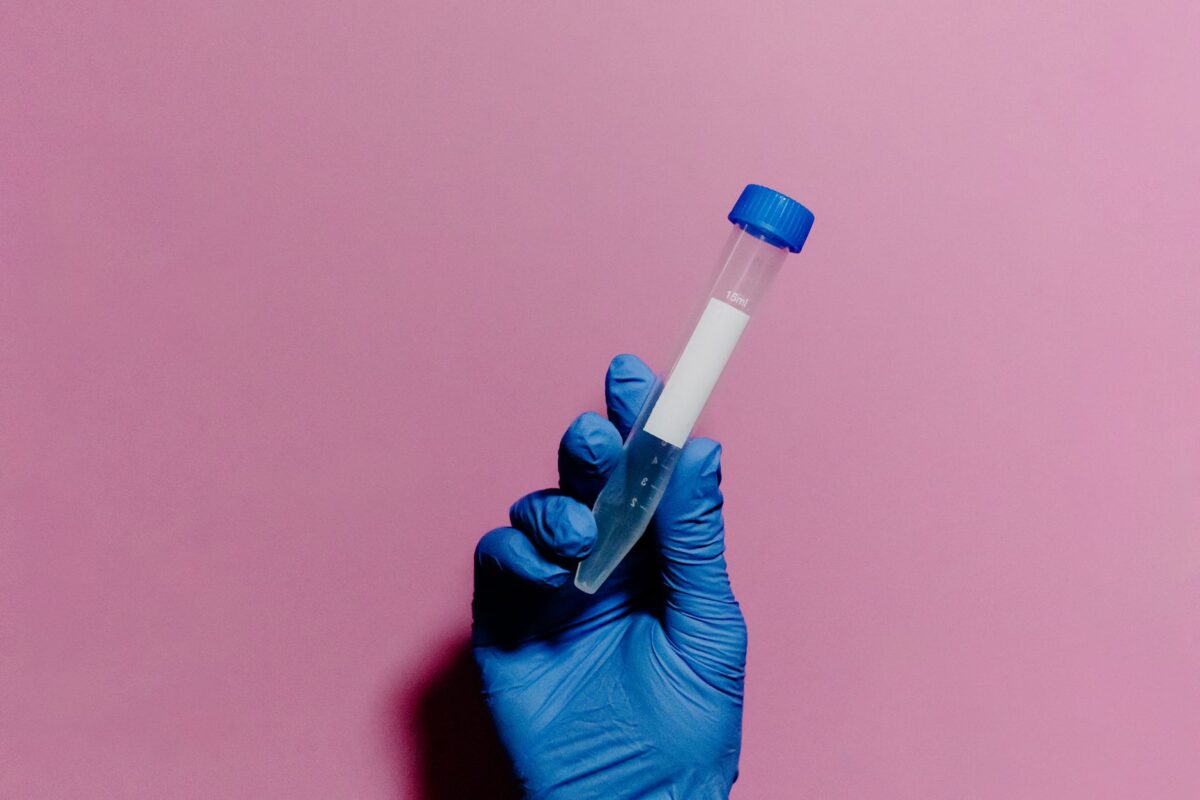quantité urine décryptage cas usage profil