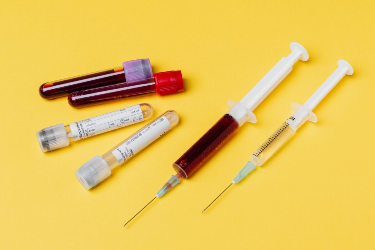 leucocytes hématies urines apparaissent