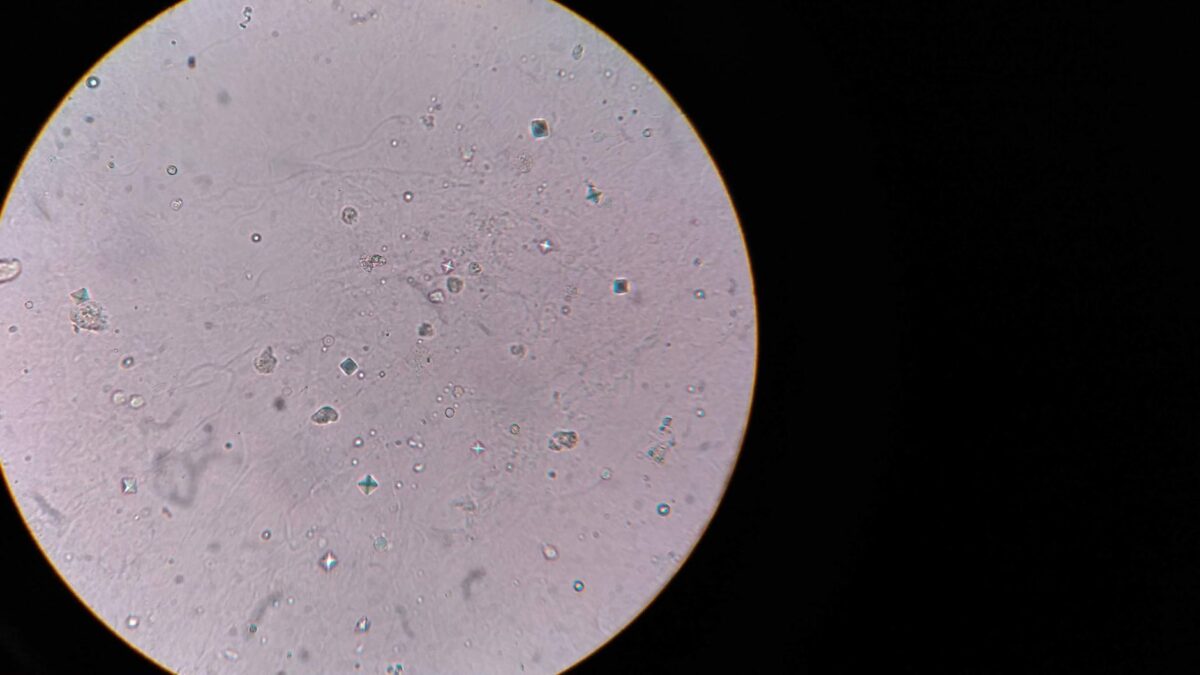 cellules épithéliales signifie résultat il lien